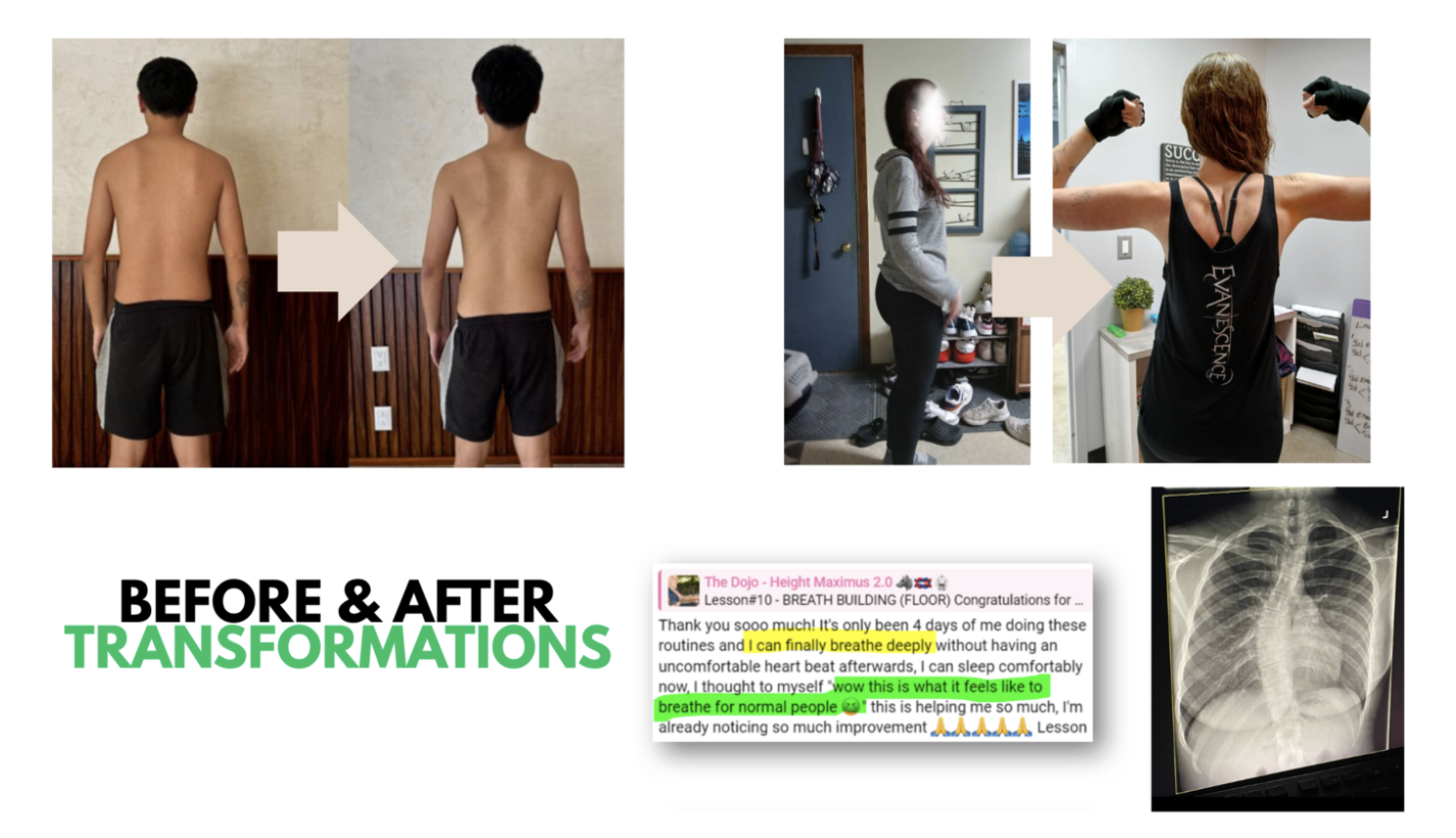Community member back view transformations showing scoliosis improvement with breathing testimonial and chest x-ray