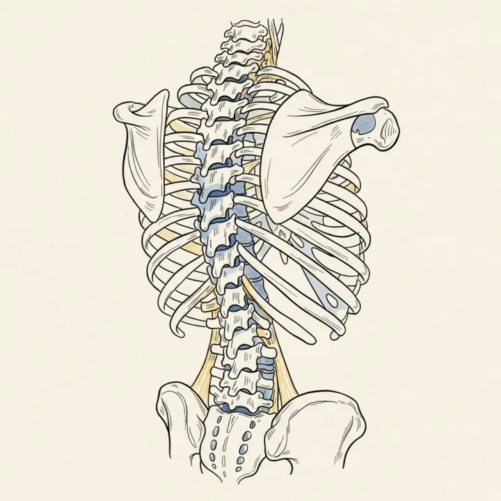 Scheuermann's Disease: Beyond the Diagnosis