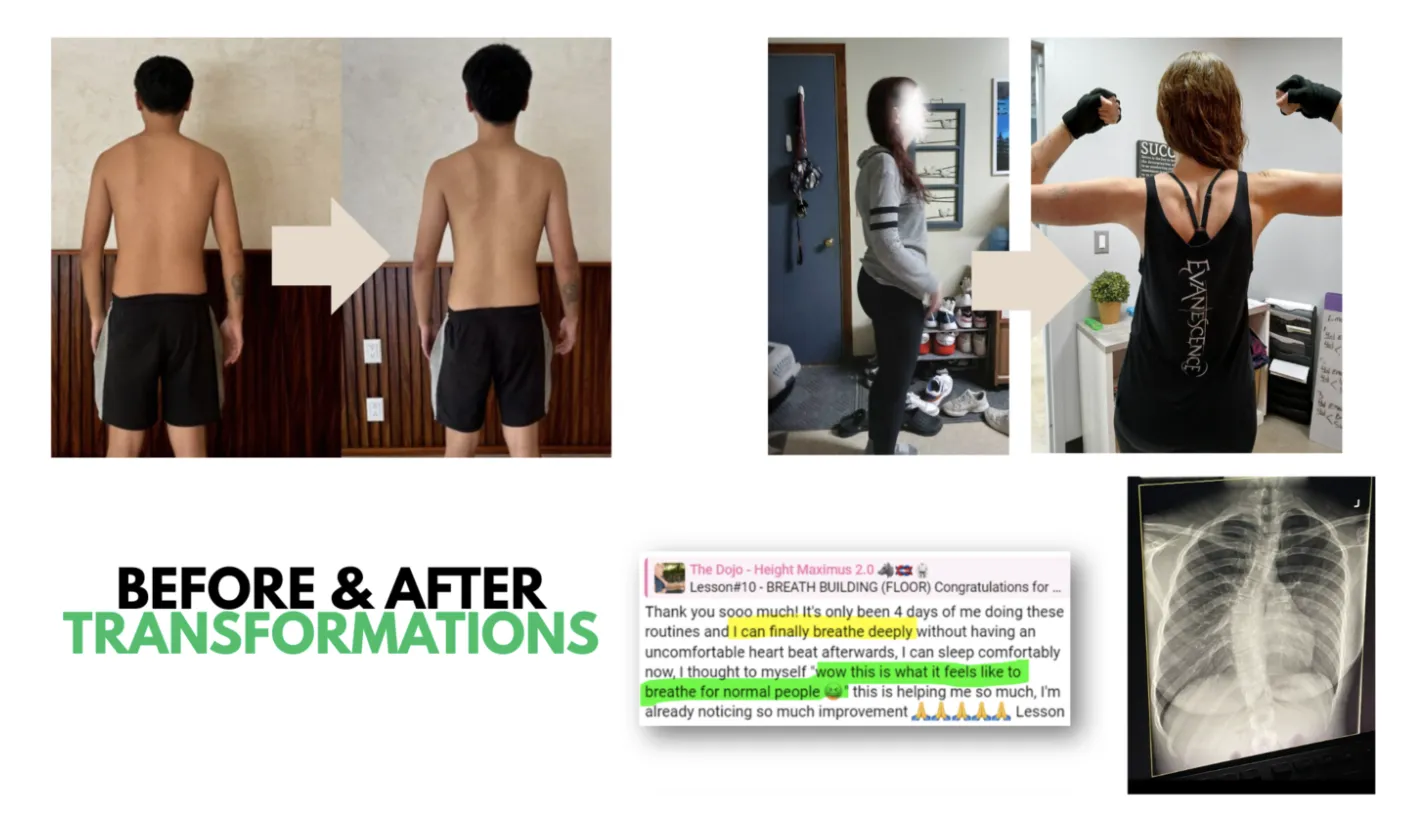 Before and after back photos from two Posture Dojo members, with a member comment about breathing more deeply and a chest X-ray