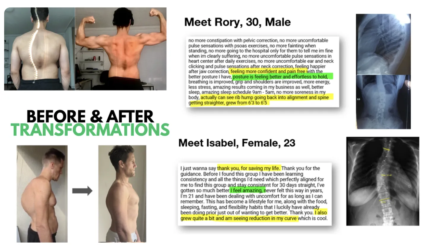 Before and after photos and X-rays from two Posture Dojo members, a man age 30 and a woman age 23, with their written testimonials